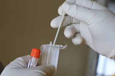 Serosurveillance (with Karnataka's Dept. of Health and Family Welfare Services, Several Other Institutions)